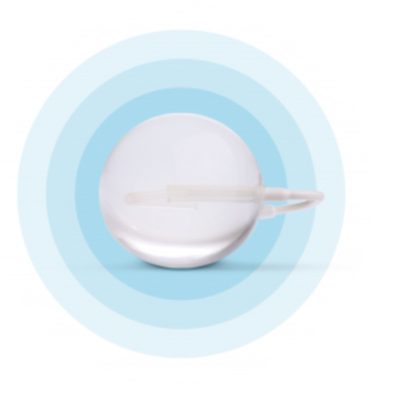 Ce-este-balonul-Spatz3